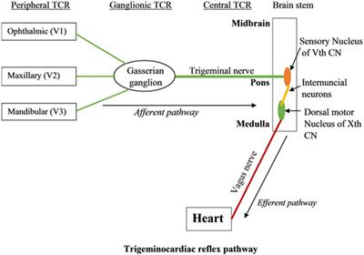 Sudden Infant Death Syndrome – Role of Trigeminocardiac Reflex: A Review